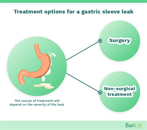 Gastric sleeve leak